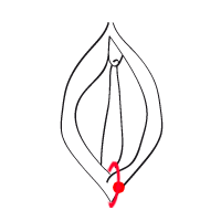 Klitorisvorhautpiercing horizontal oder vertikal
